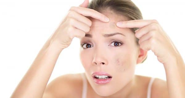 How-To-Remove-Dark-Spots-Naturally