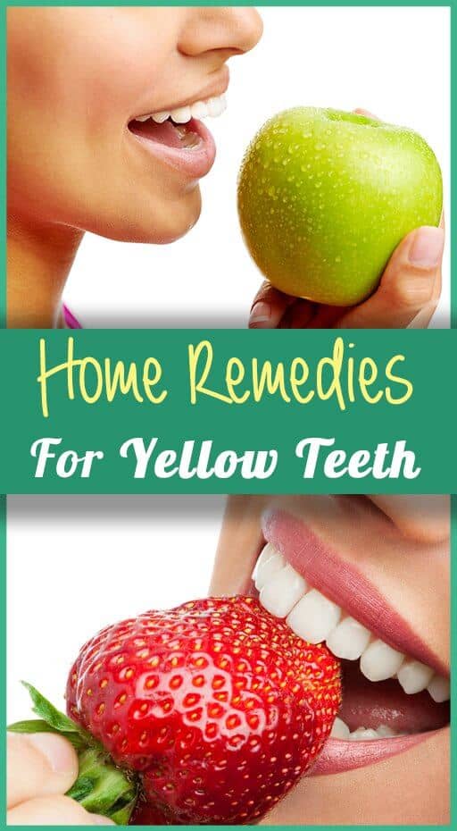 9 Home Remedies For Yellow Teeth That Really Work