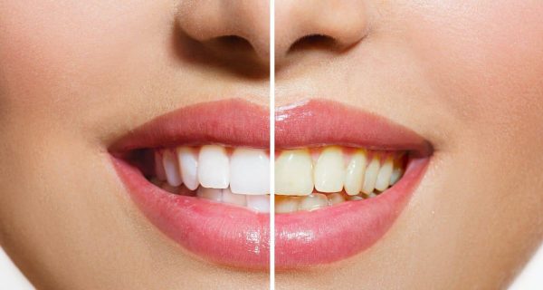 Other baking soda beauty recipes