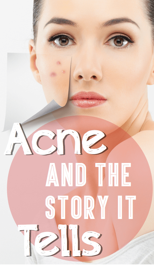 Acne And The Story It Tells