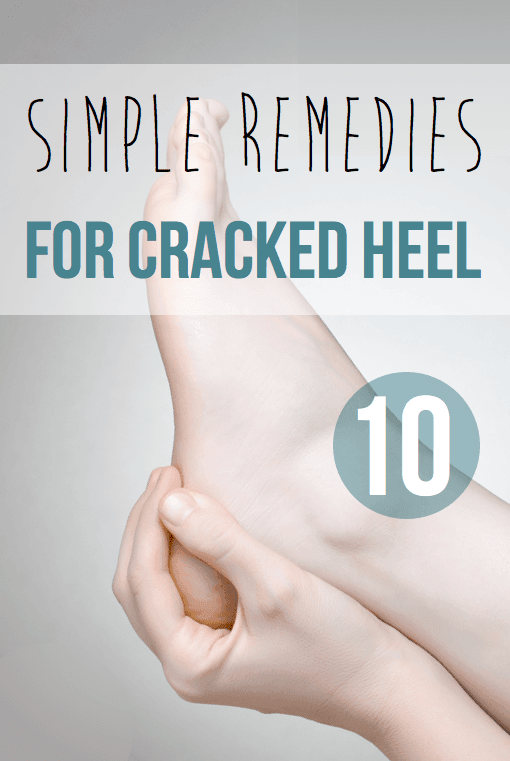 Home Remedy for Cracked Heels with Wax & Mustard Oil Treatment! - YouTube