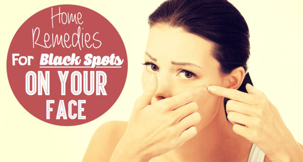 Home Remedies For Black Spots On Your Face