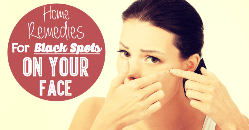 Home Remedies For Black Spots On Your Face