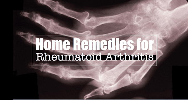 Home Remedies for Rheumatoid Arthritis