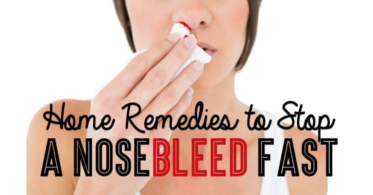 Home Remedies to Stop a NoseBleed Fast