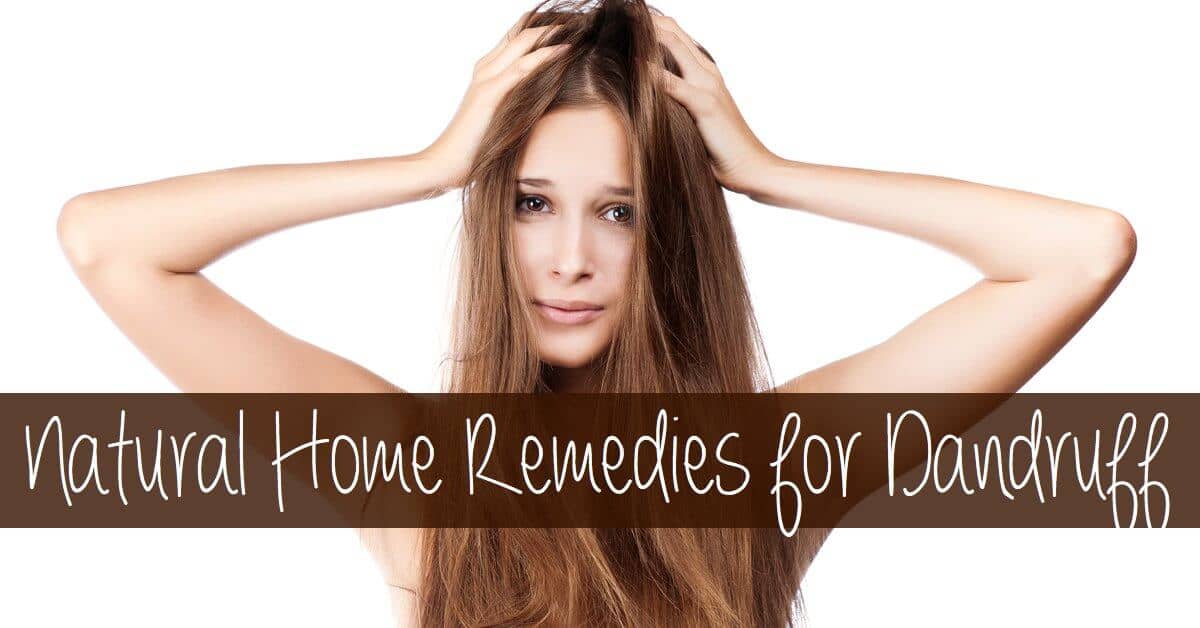 Natural Home Remedies for Dandruff