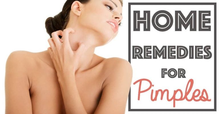 Home remedies for Pimples